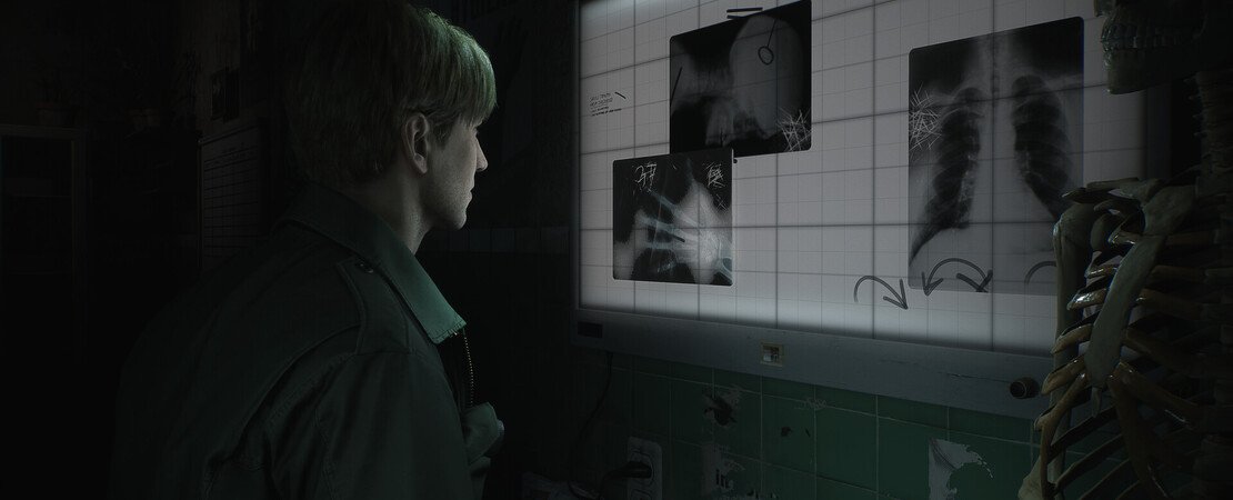 De Silent Hill 2 Remake - Alles wat je moet weten in één oogopslag