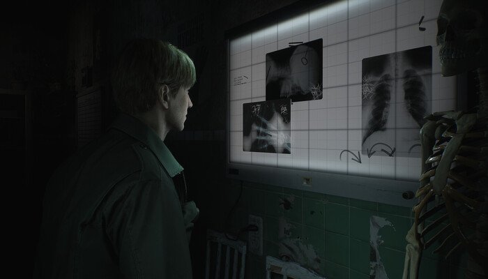 De Silent Hill 2 Remake: Alles wat je moet weten in één oogopslag